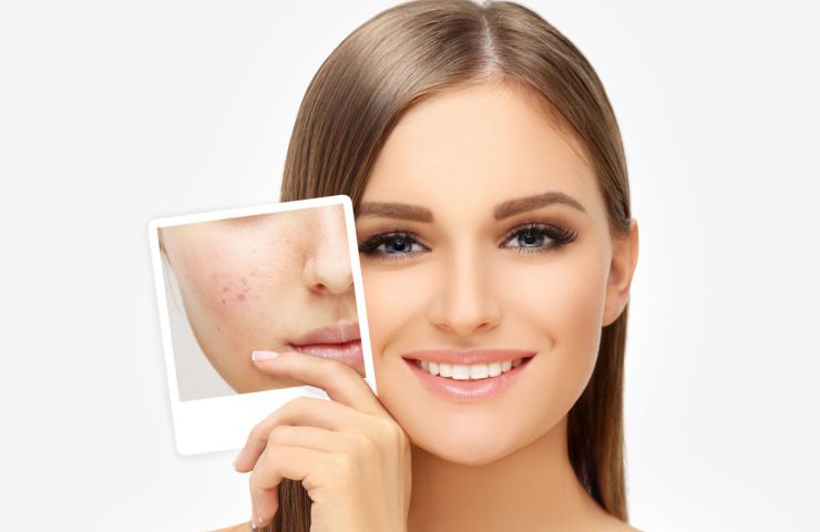 dark circle remover cream in pakistan
