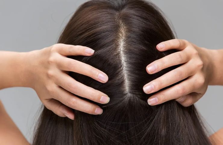 Anti-Dandruff Shampoo in Pakistan