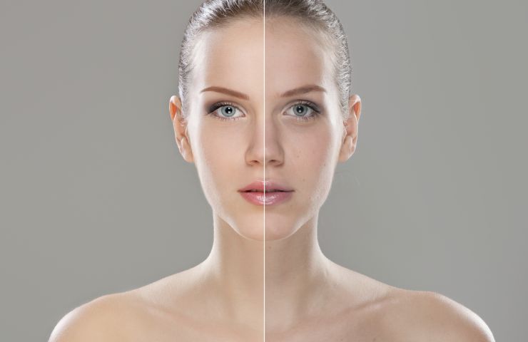 Skin Whitening Serum in Pakistan