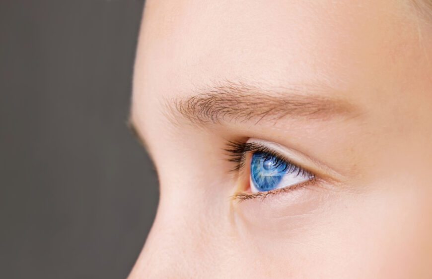 dark circle remover cream in Pakistan